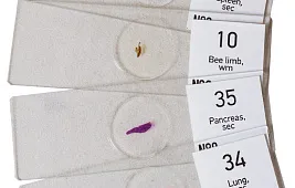 Вирусы под микроскопом